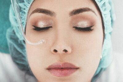 How to get rid of acne scars How to get rid of acne scars